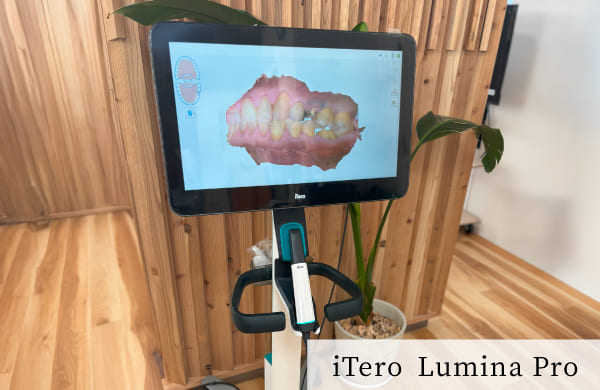 最先端の口腔内スキャナーの画像／機器名称：iTero　Lumina Pro