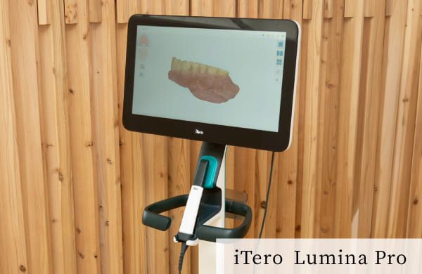 最先端の口腔内スキャナーの画像／機器名称：iTero　Lumina Pro